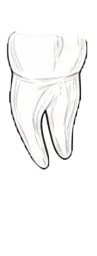 Dente 75