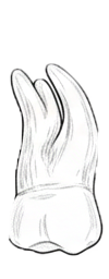 Dente 17