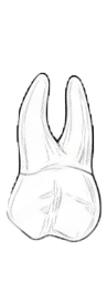Dente 18