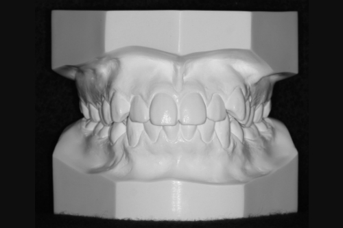 radiogyn-radiologia-modelo-gesso