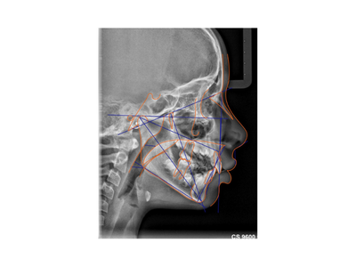 radiogyn-radiologia-analise-cefalometrica