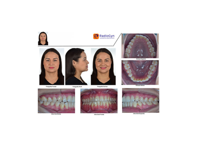 radiogyn-radiologia-documentacao-tipo-um