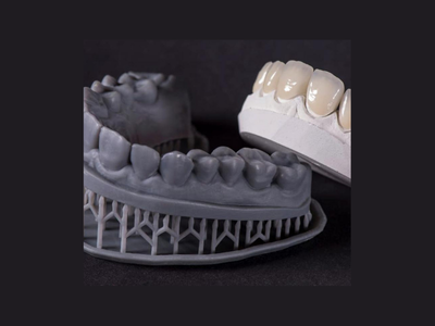 radiogyn-radiologia-modelo-3d-resina