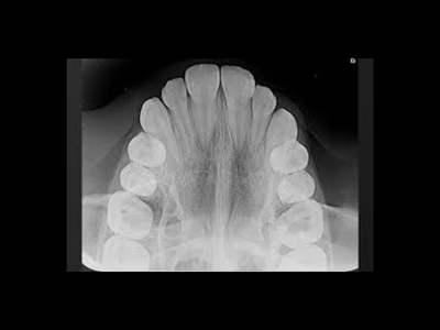 radiogyn-radiologia-oclusal