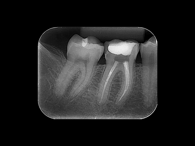 radiogyn-radiologia-periapical