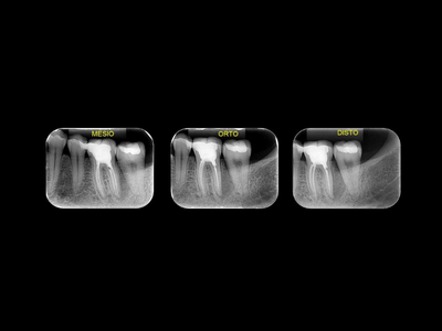 radiogyn-radiologia-tecnica-localizacao