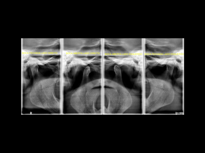 radiogyn-radiologia-atm