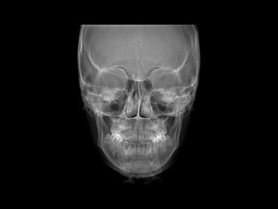 radiogyn-radiologia-telerradiografia-frontal.png