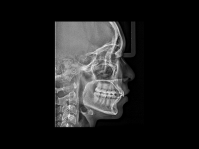 radiogyn-radiologia-telerradiografia-frontal.png