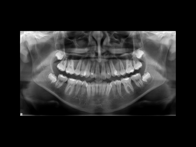 radiogyn-radiologia-telerradiografia-panoramica.png