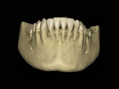 radiogyn-radiologia-tomografia-maxila