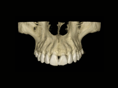 radiogyn-radiologia-tomografia-maxila