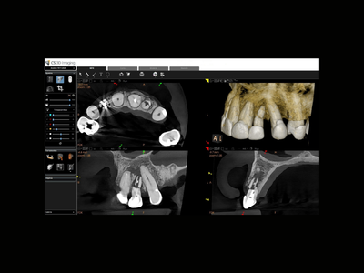 radiogyn-radiologia-tomografia-atm